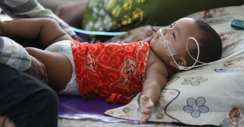 হাম উপসর্গে প্রাণ গেল আরও ৫ শিশুর